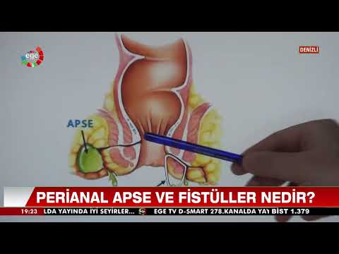 Video: Dişleri Hızlı Beyazlatmanın 3 Yolu