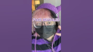 I FACE REVEALED ON ACCIDENT…