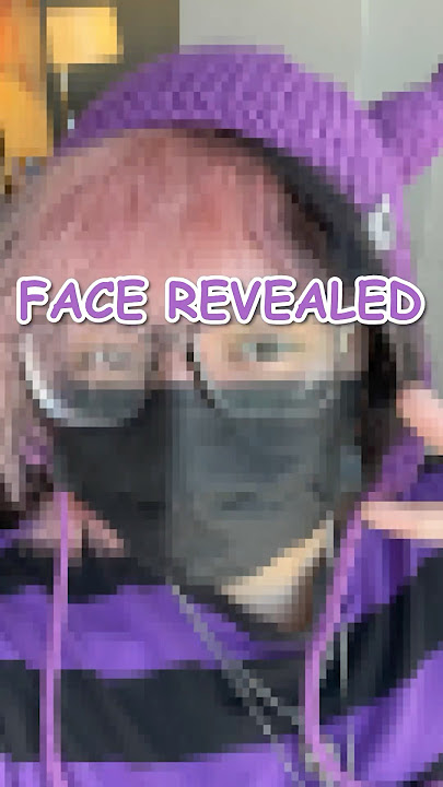 I FACE REVEALED ON ACCIDENT…