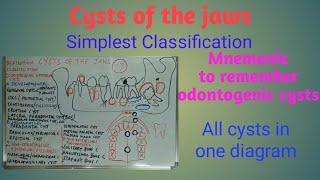 Cysts of the jaws  definition, classification, origin and location