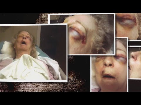 Video: Family Sues Georgia Nursing Home After 93-year-old Model Was Eaten Alive By Mites