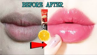 Lighten Dark Lips Fast At Home | បំបាត់បបូរមាត់ខ្មៅត្រឹមតែ៣ថ្ងៃ| How To Get Rid Of Dark Lips At Home screenshot 3