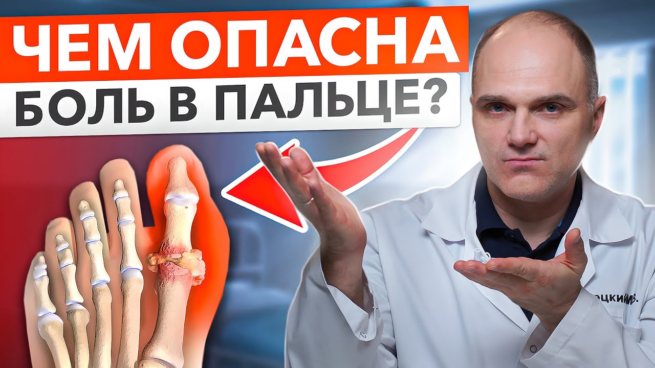 Эти причины артроза большого пальца стопы легко узнает каждый. Что такое Халюс Ригидус?