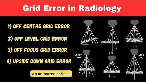 Grid error in Radiology ll An animated series #9 ll Anti-scatter grid  #grid #scattered