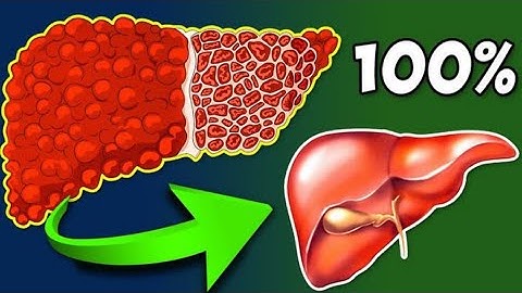 How To CLEAN Your LIVER in 3 Days!