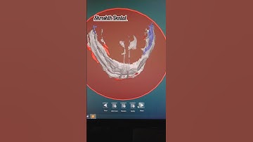 Exocad tutorial for beginners. Exocad scanning.scanning design exocad.