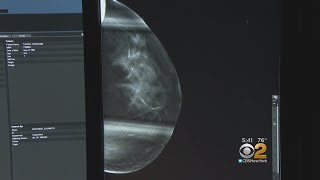 New Way To Test Breast Cancer Drugs