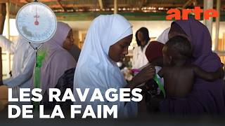 Au Nigeria, le fléau de la malnutrition | ARTE Info