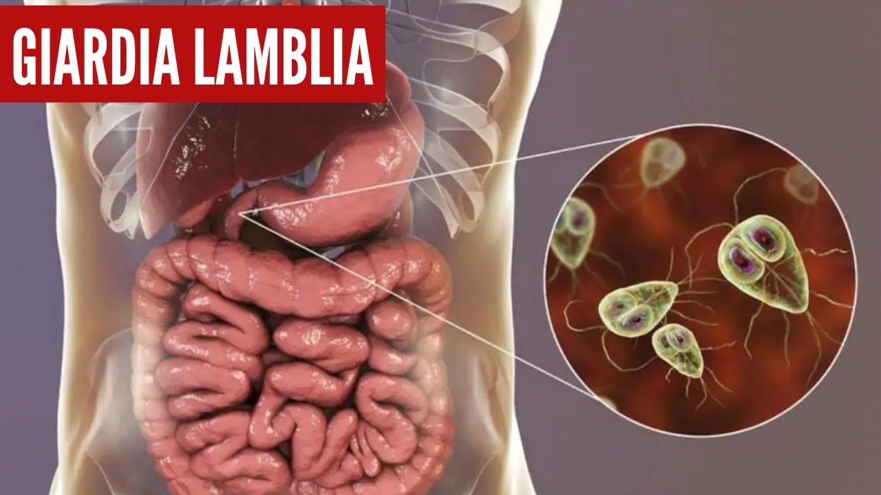 Giardia lambia ciclo de vida, microscopio YouTube