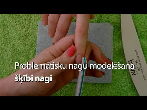 Videó: Mi az a Nagi letiltási modell?