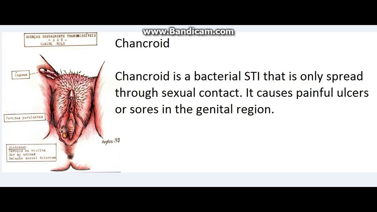 Can sickle cell be transmitted sexually
