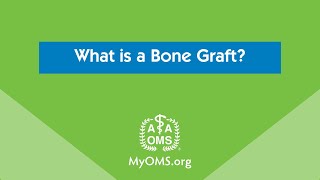 What is a Bone Graft?