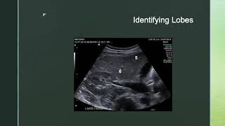 Ultrasound and Liver Segments