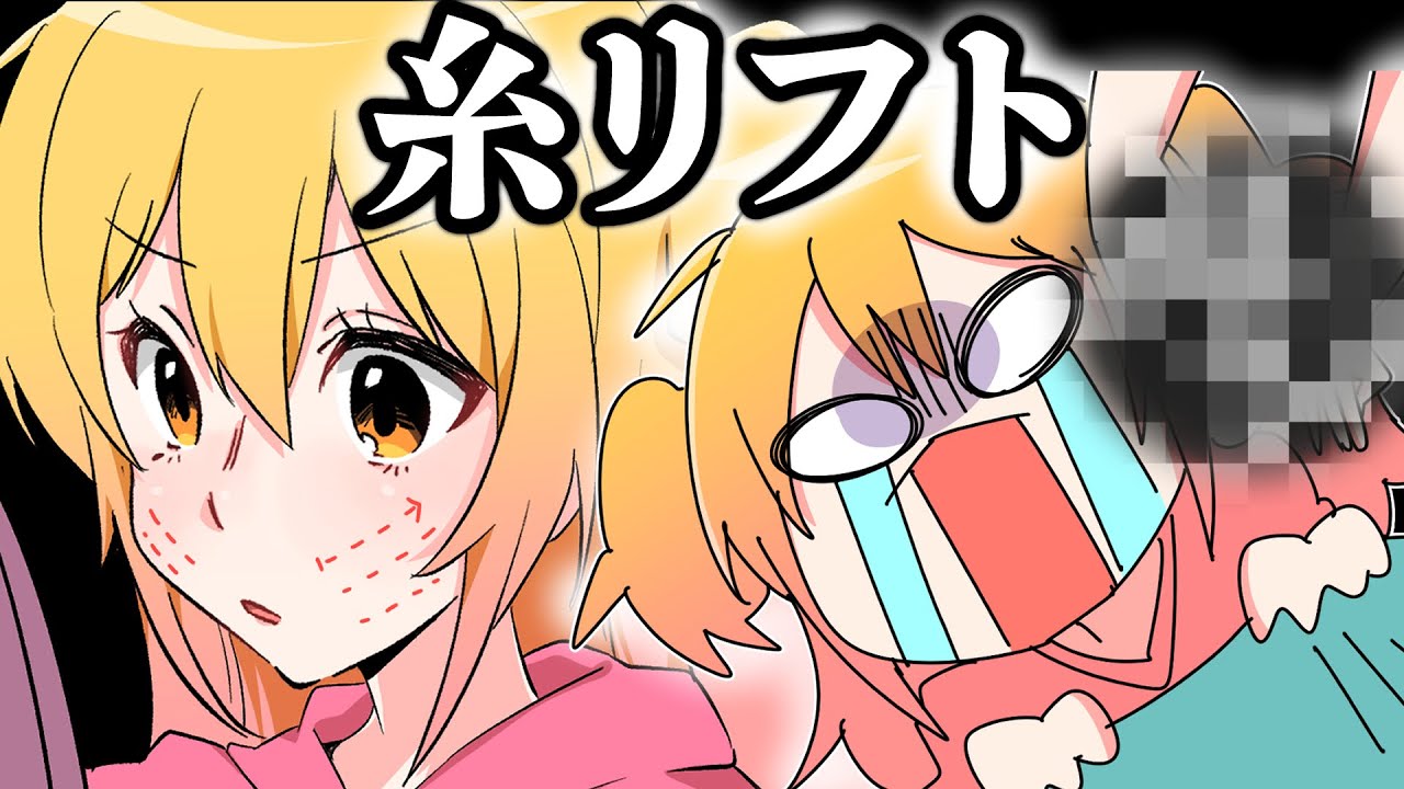 糸リフトをしに整形外科に行った話 【実話】