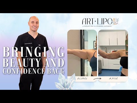 Dr. George Kardashian Answers FAQs 💬 Why He Loves Liposuction & Why Women Choose ArtLipo (Tampa, FL)