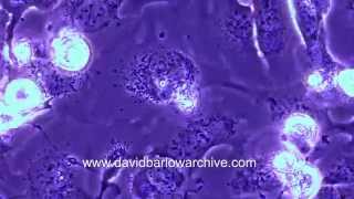 Ovarian Cancer Cells with Virus by David Barlow 1,550 views 9 years ago 4 minutes, 40 seconds