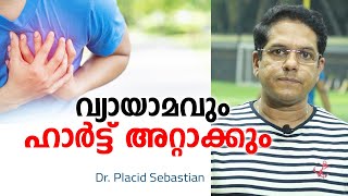 വ്യായാമം ഹാർട്ട് അറ്റാക്കിന് കാരണമാവുമോ | Heart attack and Exercises | Malayalam Health tips