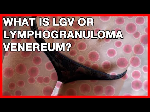 What Is LGV Or Lymphogranuloma Venereum? Signs And Symptoms Of Chlamydia In Men