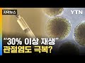 연골세포를 이용하면 퇴행성 관절염 30% 이상 재생