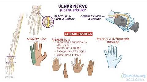 Anatomy clinical correlates - Median, ulnar and radial nerves - ATF
