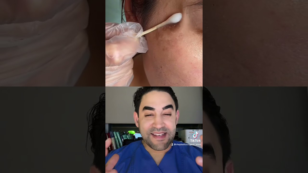 Muttermal einfach wegwischen - geht das? 