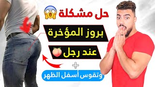 حل مشكلة بروز المؤخرة عند الرجال وتقوس اسفل الظهر بسرعة  | الأسباب وتمارين العلاج