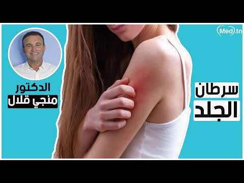 فيديو: مُنحت جائزة دايسون لمخترعي ماسح سرطان الجلد