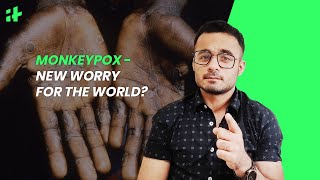 Monkeypox - New Worry For The World