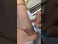 Intramuscular Injection Technique Explained | Safe IM Injection Step-by-Step|Nurse Guide Class 2