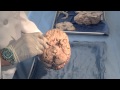 Orientation: The Planes of the Brain: Neuroanatomy Video Lab - Brain Dissections