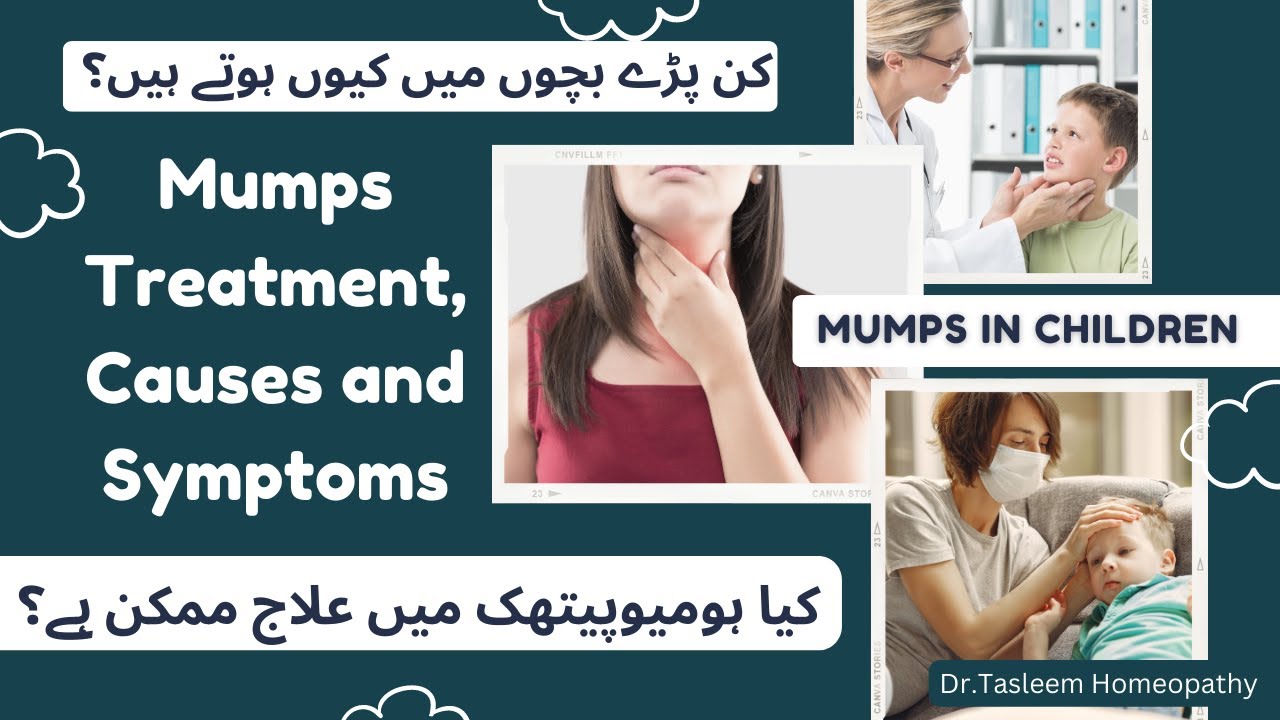 Causes of Mumps and its Treatment in urdu/Hindi mumps treatment in