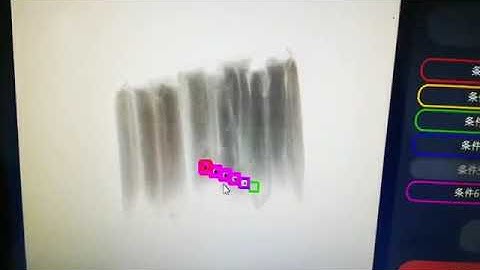 X-ray Metal Detector