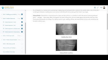Start-Tech Academy iStep Program Task4: Osteoarthritis detection using Deep Learning
