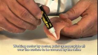 Deflex flexible dentures Video 9 Acrylic relining screenshot 3