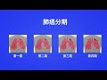 为什么肺癌分期很重要？