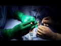 33-Year-Old Man’s Sperm Retrieval Journey | Procedure