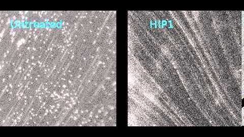 platelet adhesion in human arteries under flow #2