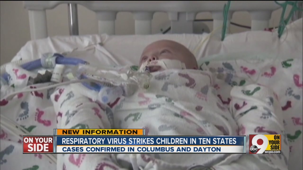 EV-D68 virus causing much concern