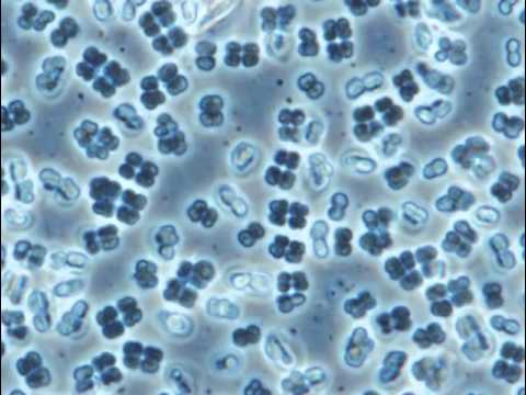 Deinococcus radiodurans