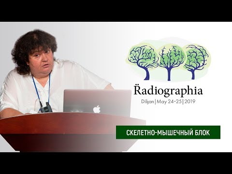 Татьяна Павленко. Опухолевые поражения проксимального отдела бедра, особенности. Разбор кейсов