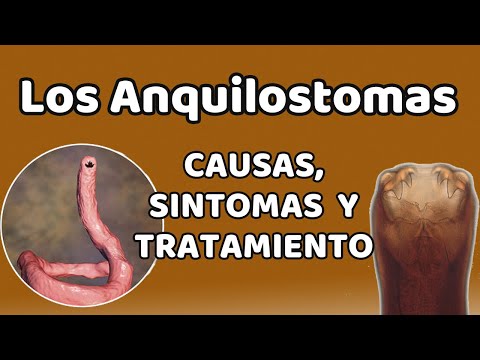 Video: ¿Cuándo se descubrió por primera vez la anquilostomiasis?