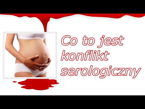 Konflikt serologiczny. Co to jest?