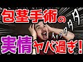 【暴露】医者が教えない包茎手術のウラ事情 全て話します