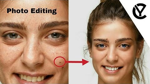 Face clear pimples and acne removed - Photo Editing - by YOUEL on {YO