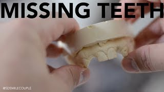 Replacing Teeth With Dental Implants!