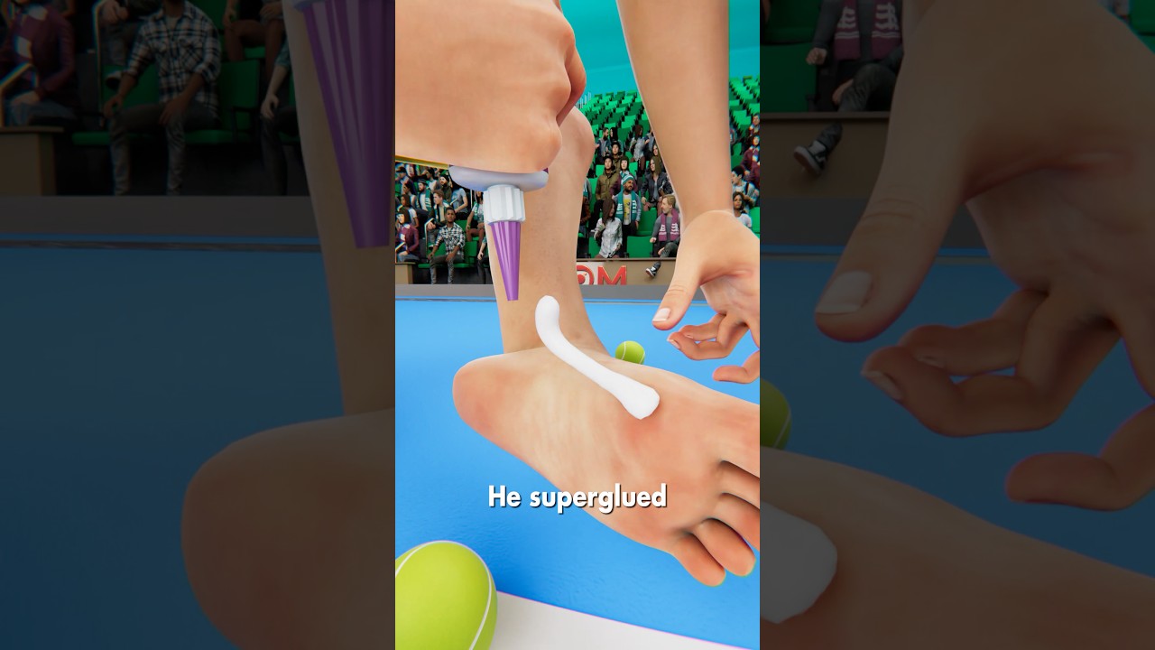 He Superglued His Foot Midgame 😳