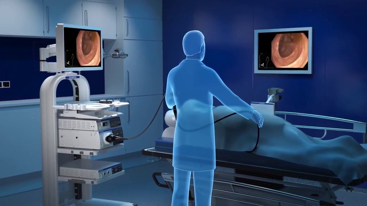 ScopeGuide Overview Olympus Evis Exera III. Методический фильм. Е.Д. Федоров