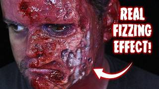 ACID BURNS WITH REAL FIZZING EFFECT!!! Halloween Makeup Tutorial! #Halloween #Makeup #Cosplay