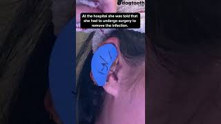Student Nearly Loses Ear On Holiday || Dogtooth Media