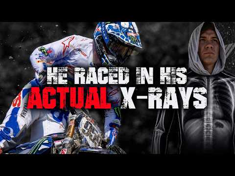He was told he would NEVER race again! | The Maxime Renaux STORY.